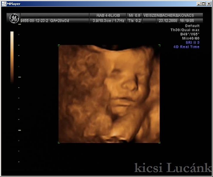 luca06