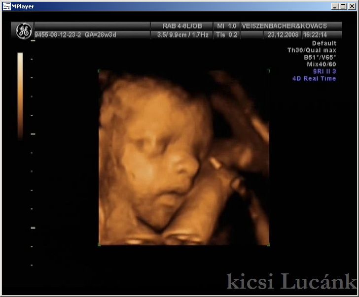 luca09