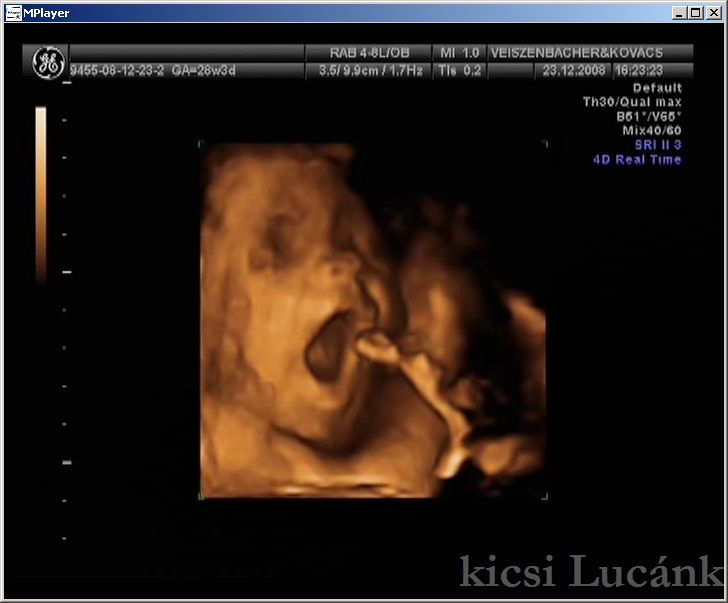 luca12